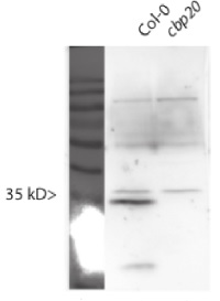 CBP20 | nuclear cap-binding protein subunit 2 in the group Antibodies for Plant/Algal / DNA/RNA/Cell Cycle / microRNA at Agrisera AB (Antibodies for research) (AS09 530)